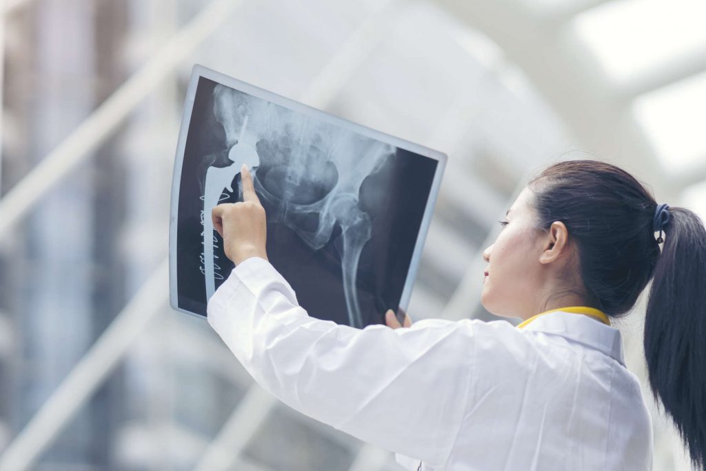 Osteogenon: Liek na rednutie kostí, podporu hojenia zlomenín a na hladinu vápnika